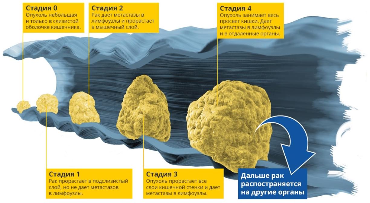 Стадии